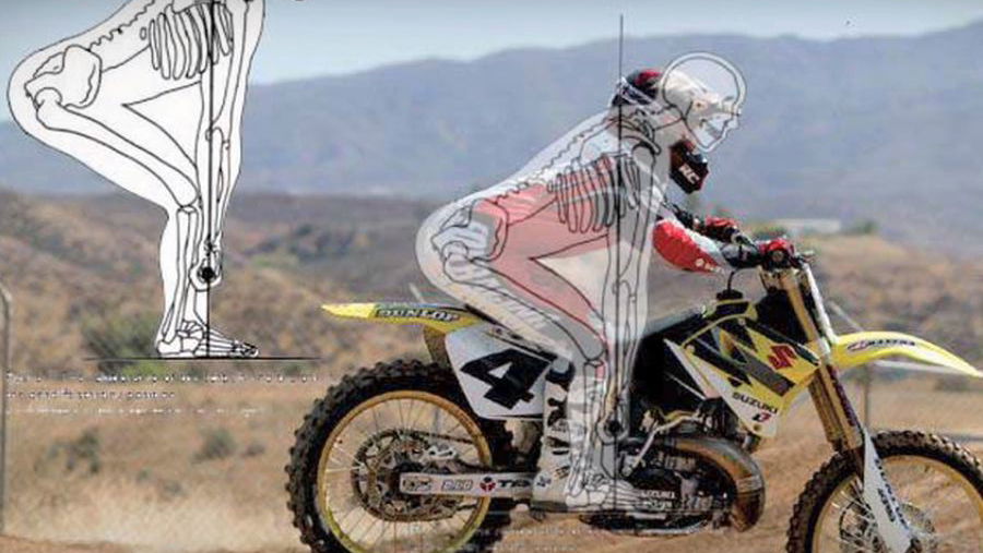 MX technique